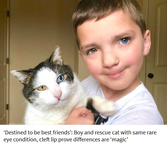同じ症状を持つ猫と奇跡的に出会った少年（画像は『Love What Matters　2018年3月27日付「‘Destined to be best friends’: Boy and rescue cat with same rare eye condition, cleft lip prove differences are ‘magic’」（Christina Humphreys）』のスクリーンショット）