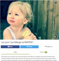 【海外発！Breaking News】汗や涙にも反応　「水アレルギー」と診断された1歳半の女児（米）