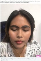 【海外発！Breaking News】眉タトゥー失敗で“極太ナメクジ眉”になった女性（タイ）