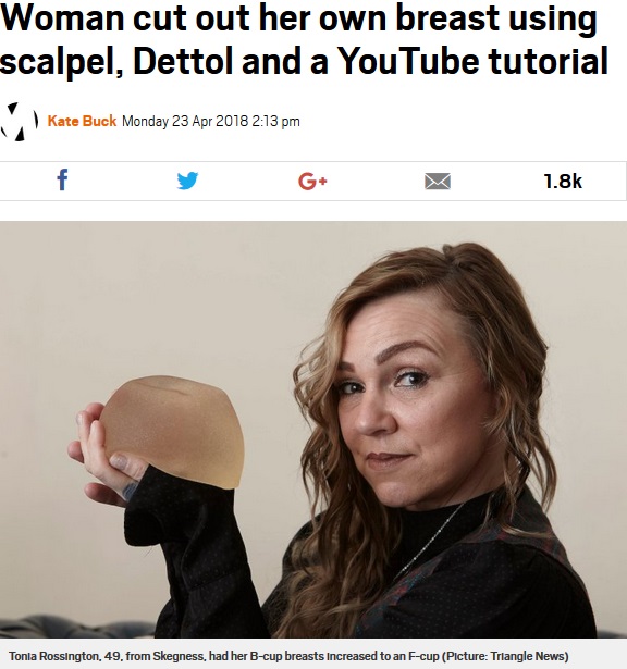 自ら胸のインプラントを除去した女性（画像は『Metro　2018年4月23日付「Woman cut out her own breast using scalpel, Dettol and a YouTube tutorial」（Picture: Triangle News）』のスクリーンショット）