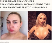 【海外発！Breaking News】「整形美女のシンボルになりたい」1,600万円超かけたトランスジェンダーの女性（独）