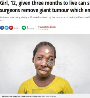 【海外発！Breaking News】顔にサッカーボール大の腫瘍を抱えた少女、手術で笑顔を取り戻す（カメルーン）