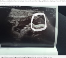 【海外発！Breaking News】「おばあちゃんがここに！」胎児のエコー写真に亡き祖母の顔が（英）