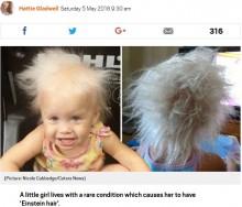 【海外発！Breaking News】「まるでアインシュタイン博士」と言われてしまう髪を持つ5歳女の子（米）