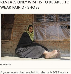 【海外発！Breaking News】「靴を履くのが夢」象皮病で足の巨大化に苦しむ女性（印）