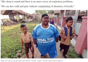 【海外発！Breaking News】「世界一の肥満児」と言われた190kgの男児、83kgの減量に成功（インドネシア）