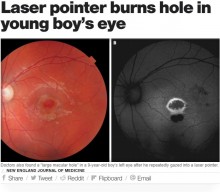 【海外発！Breaking News】レーザーポインターで遊んでいた9歳男児、網膜に穴が空く（ギリシャ）
