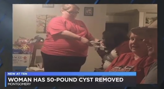 妊婦のような体型だった女性（画像は『WSFA 12 News　2018年6月28日付「Alabama woman has 50-pound ovarian cyst removed」』のスクリーンショット）
