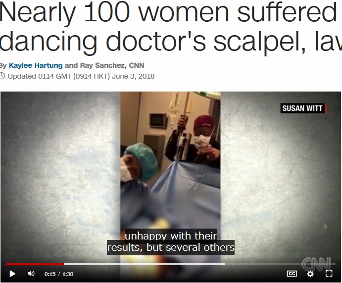 ダンスしながら手術する女医師に患者から苦情殺到（画像は『CNN　2018年6月3日付「Nearly 100 women suffered under dancing doctor’s scalpel, lawyer says」』のスクリーンショット）