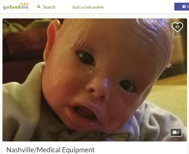 ハーレークイン魚鱗癬と闘う1歳児（画像は『GoFundMe　2018年4月21日付「Nashville/Medical Equipment」』のスクリーンショット）