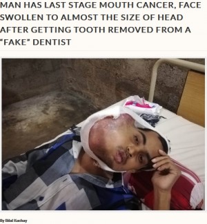 【海外発！Breaking News】歯の痛みで偽医師により抜歯した男性、後に口腔がんが発覚（パキスタン）