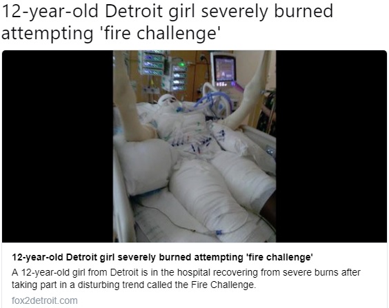 身体の約50％に火傷を負った12歳少女（画像は『FOX 2 Detroit News　2018年8月21日付「12-year-old Detroit girl severely burned attempting ‘fire challenge’」）』のスクリーンショット）