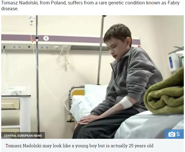 ファブリー病に苦しむ25歳男性（画像は『The Sun　2018年8月13日付「‘I HATE THE BOY IN THE MIRROR’ Man, 25, trapped in body of a 12-year-old boy due to rare disease lives in constant pain and nobody believes his real age」（IMAGE: CENTRAL EUROPEAN NEWS）』のスクリーンショット）
