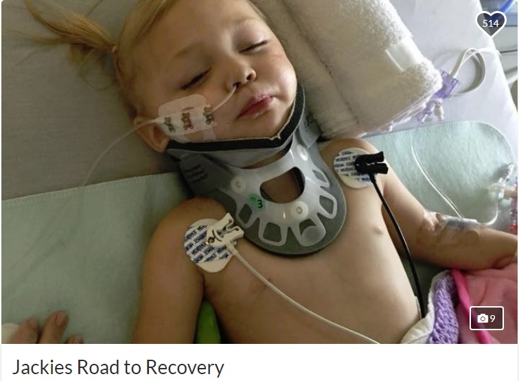 病院で治療を受ける2歳の女の子（画像は『GoFundMe　2018年7月24日付「Jackies Road to Recovery」』のスクリーンショット）