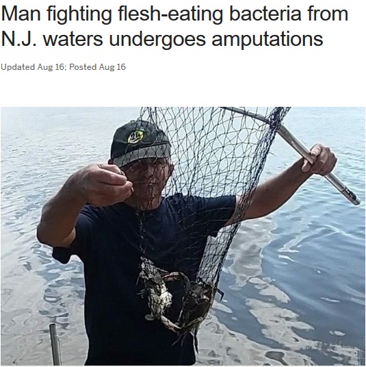 カニ捕り中に人食いバクテリアに感染した男性（画像は『NJ.com　2018年8月16日付「Man fighting flesh-eating bacteria from N.J. waters undergoes amputations」（Courtesy of Dilena Perez-Dilan）』のスクリーンショット）