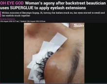 【海外発！Breaking News】瞬間接着剤で“まつエク”された女性「全てのまつ毛を失った」（タイ）