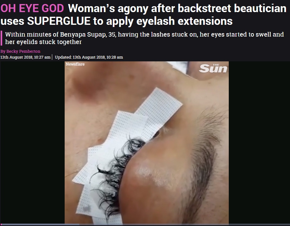 瞬間接着剤を除去する施術を受けた女性（画像は『The Sun　2018年8月13日付「OH EYE GOD Woman’s agony after backstreet beautician uses SUPERGLUE to apply eyelash extensions」』のスクリーンショット）
