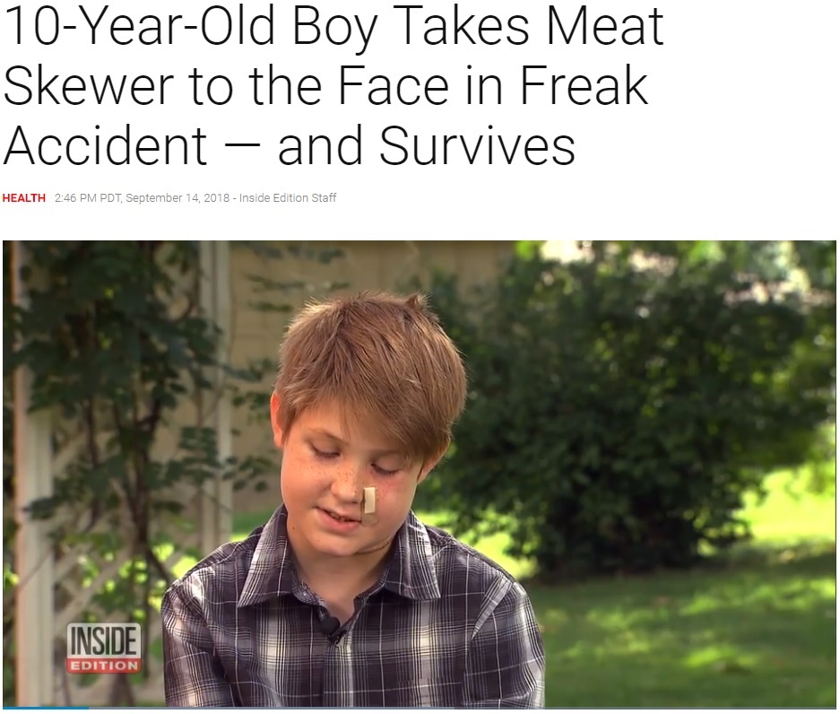 鉄串が顔面を突き刺すも助かった少年（画像は『Inside Edition　2018年9月14日付「10-Year-Old Boy Takes Meat Skewer to the Face in Freak Accident — and Survives」』のスクリーンショット）