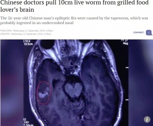 【海外発！Breaking News】BBQが好きな男性の脳から10センチの寄生虫を摘出（中国）