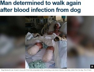 【海外発！Breaking News】犬の唾液から感染症に罹った男性、四肢切断も「今でも犬は好き」（米）