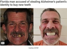 【海外発！Breaking News】他人のIDを盗用し“歯”を購入した男、逮捕時に笑顔のマグショット（米）