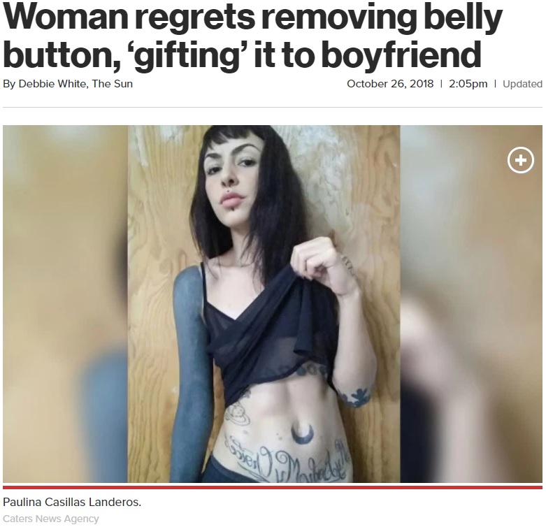 家族への腹いせにヘソを摘出した女性（画像は『New York Post　2018年10月26日付「Woman regrets removing belly button, ‘gifting’ it to boyfriend」（Caters News Agency）』のスクリーンショット）