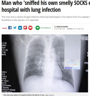【海外発！Breaking News】臭い靴下を毎日嗅ぎ続けた男性、肺真菌症で緊急入院（中国）