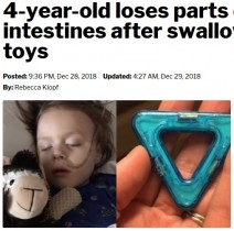 【海外発！Breaking News】おもちゃの中の磁石を13個誤飲した4歳男児、腸の一部を切除（米）