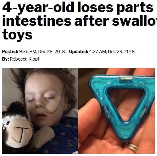 おもちゃの中に入っている磁石を誤飲した4歳児（画像は『TMJ4.com　2018年12月29日付「4-year-old loses parts of his colon, intestines after swallowing magnetic toys」』のスクリーンショット）