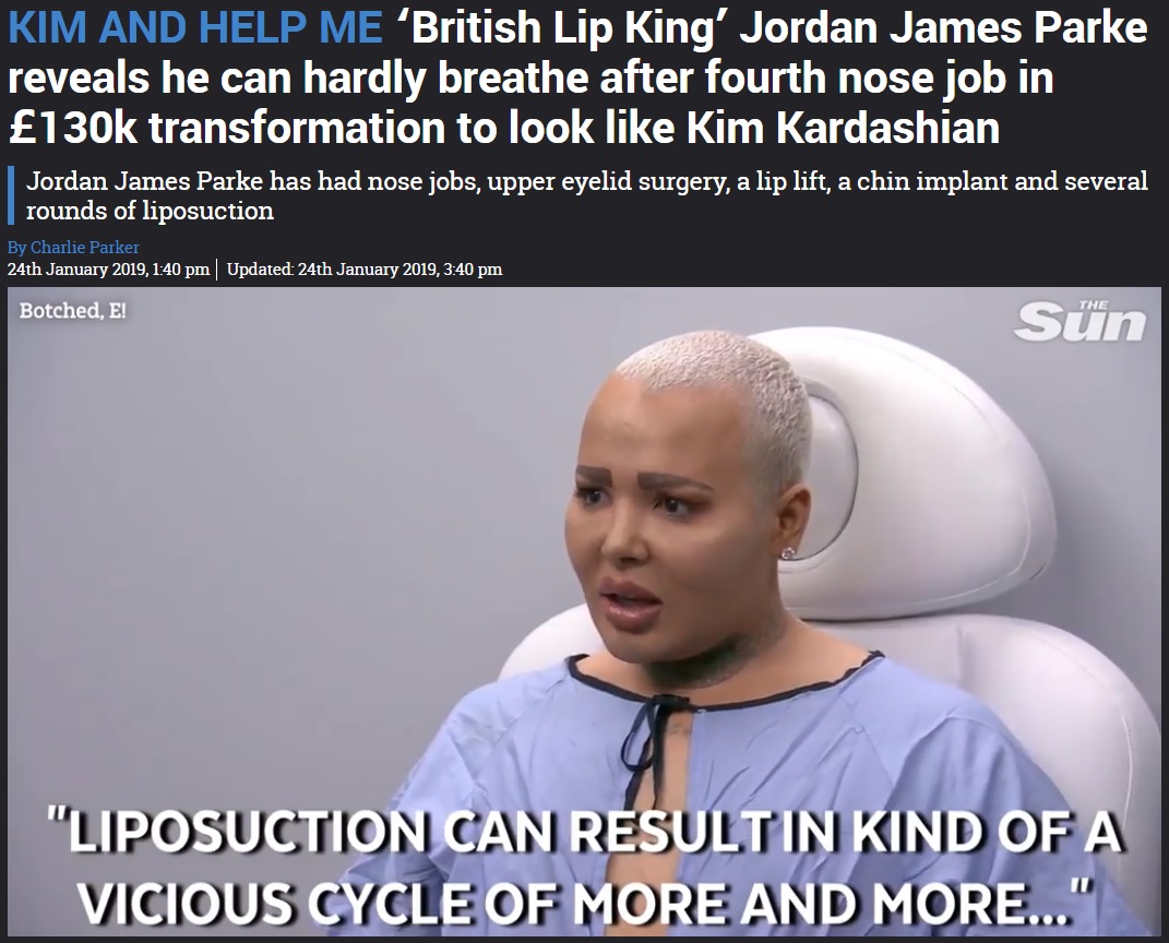 「キム・カーダシアンのように」と美容整形を繰り返す男性（画像は『The Sun　2019年1月24日付「KIM AND HELP ME ‘British Lip King’ Jordan James Parke reveals he can hardly breathe after fourth nose job in ￡130k transformation to look like Kim Kardashian」』のスクリーンショット）