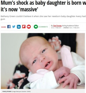 【海外発！Breaking News】3,000人に1人　前歯が生えた状態で生まれた赤ちゃん（英）