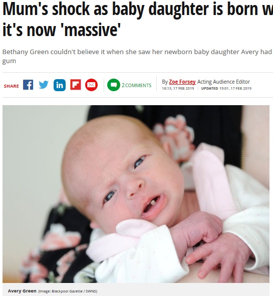 前歯が1本生えた状態で生まれた赤ちゃん（画像は『Mirror　2019年2月17日付「Mum’s shock as baby daughter is born with a tooth - and it’s now ‘massive’」（Image: Blackpool Gazette / SWNS）』のスクリーンショット）