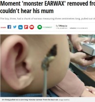 【海外発！Breaking News】母親の声が聞こえなかった幼児に巨大な耳垢が（台湾）