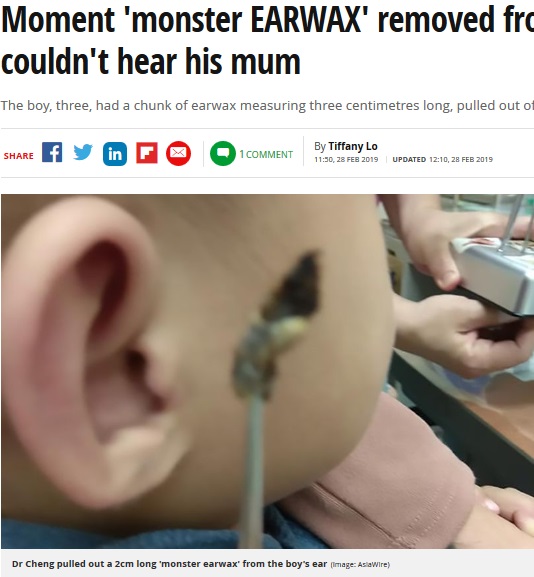 幼児の耳から2cmサイズの耳垢を除去（画像は『Mirror　2019年2月28日付「Moment ‘monster EARWAX’ removed from toddler who couldn’t hear his mum」（Image: AsiaWire）』のスクリーンショット）