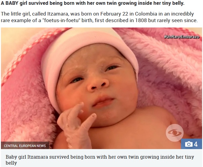 胎児内胎児という非常に珍しい先天性奇形で生まれた女児（画像は『The Sun　2019年3月21日付「‘PREGNANT’ NEWBORN Little girl is born with her own 14g twin growing INSIDE her tiny belly stunning doctors」（Credit: CENTRAL EUROPEAN NEWS）』のスクリーンショット）