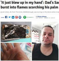 【海外発！Breaking News】リセットを試みたサムスンのスマホ、手のひらの上で爆発（英）