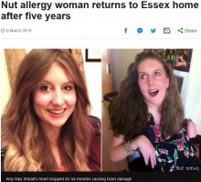 【海外発！Breaking News】旅先のチキン料理で脳にダメージを負ったナッツアレルギーの女性、5年ぶりに帰宅（英）