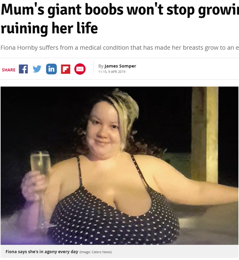巨乳すぎてつらいと話す女性（画像は『Daily Record　2019年4月9日付「Mum’s giant boobs won’t stop growing and they’re ruining her life」（Image: Caters News）』のスクリーンショット）