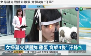 【海外発！Breaking News】眼の中に4匹の生きた蜂　女性の涙を飲んでへばりつく（台湾）