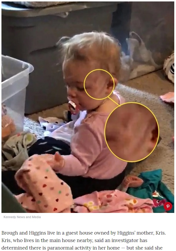 赤ちゃんの顔の傷はゴーストによるもの？（画像は『People.com　2019年3月26日付「Michigan Couple Says They Caught a Ghost on Nanny Cam After Finding Scratches on Baby’s Face」（Kennedy News and Media）』のスクリーンショット）