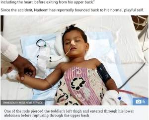 【海外発！Breaking News】180センチの鉄棒が体を貫通した3歳児、奇跡的に助かる（印）