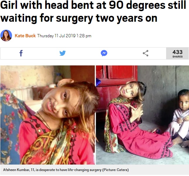 首が90度曲がったままのパキスタンの少女（画像は『Metro　2019年7月11日付「Girl with head bent at 90 degrees still waiting for surgery two years on」（Picture: Caters）』のスクリーンショット）