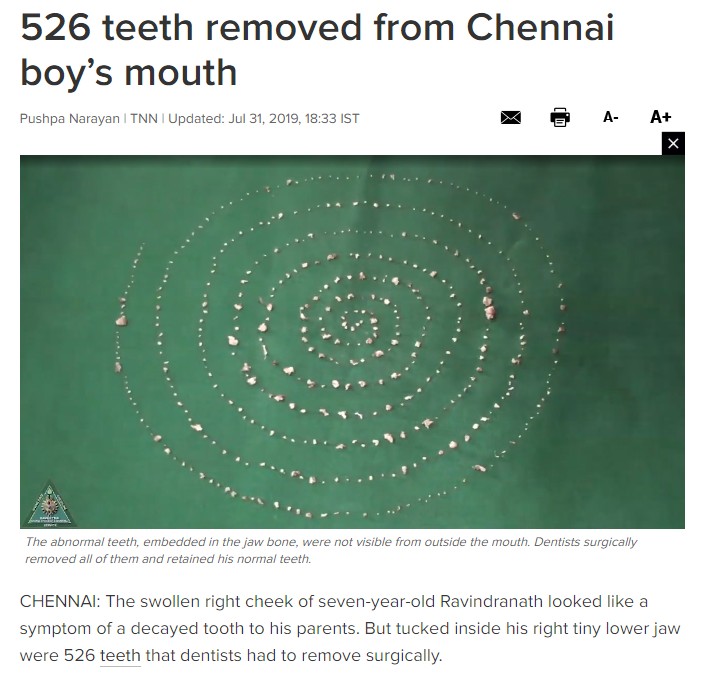 男児の口から摘出された歯（画像は『Times of India　2019年7月31日付「526 teeth removed from Chennai boy’s mouth」』のスクリーンショット）