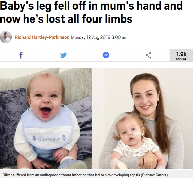 四肢を切断する前と治療中の男児（画像は『Metro　2019年8月12日付「Baby’s leg fell off in mum’s hand and now he’s lost all four limbs（Picture: Caters）』のスクリーンショット）