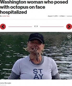 【海外発！Breaking News】タコを顔に載せて写真撮影した女性、噛まれて出血し病院へ（米）