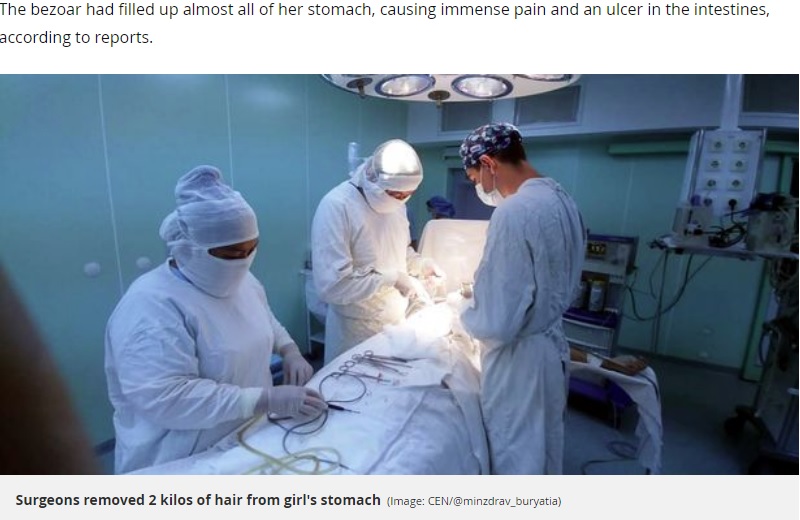 毛髪の塊を摘出する医師ら（画像は『Mirror　2019年10月4日付「Huge 20-inch hairball cut out of teenager’s stomach by surgeons」（Image: CEN/＠minzdrav_buryatia）』のスクリーンショット）