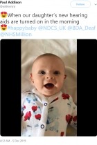 【海外発！Breaking News】聴覚障がいの赤ちゃん、補聴器をつけた時の反応が超キュート（英）＜動画あり＞