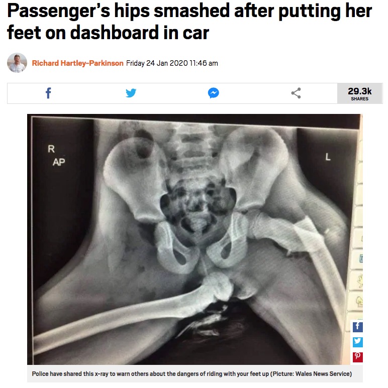 「ダッシュボードに足をのせている人にこの写真を見せて」とプライス巡査長（画像は『Metro 2020年1月24日付 「Passenger’s hips smashed after putting her feet on dashboard in car」（Picture: Wales News Service）』のスクリーンショット）