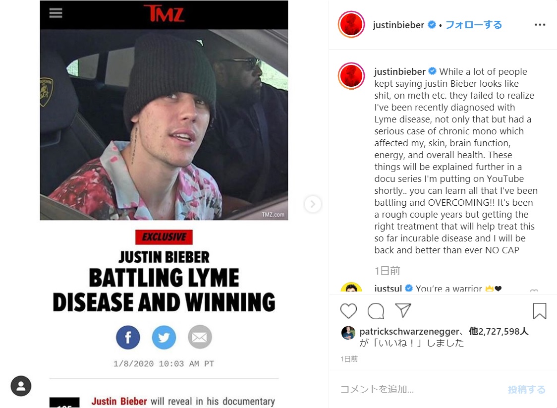 「ライム病」を告白したジャスティン・ビーバー（画像は『Justin Bieber　2020年1月8日付Instagram「While a lot of people kept saying justin Bieber looks like shit, on meth etc.」』のスクリーンショット）