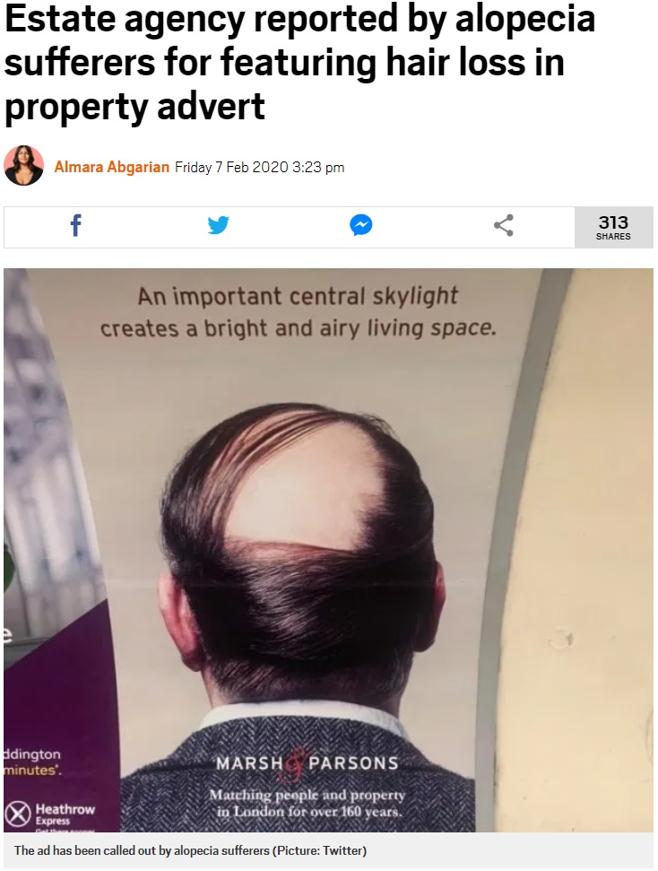 不動産会社による広告ポスター（画像は『Metro　2020年2月7日付「Estate agency reported by alopecia sufferers for featuring hair loss in property advert」（Picture: Twitter）』のスクリーンショット）